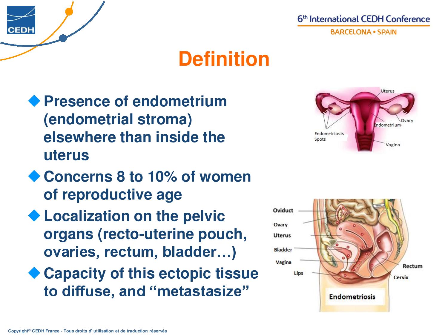 Endometriosis C. Charvet DEF EN page 002