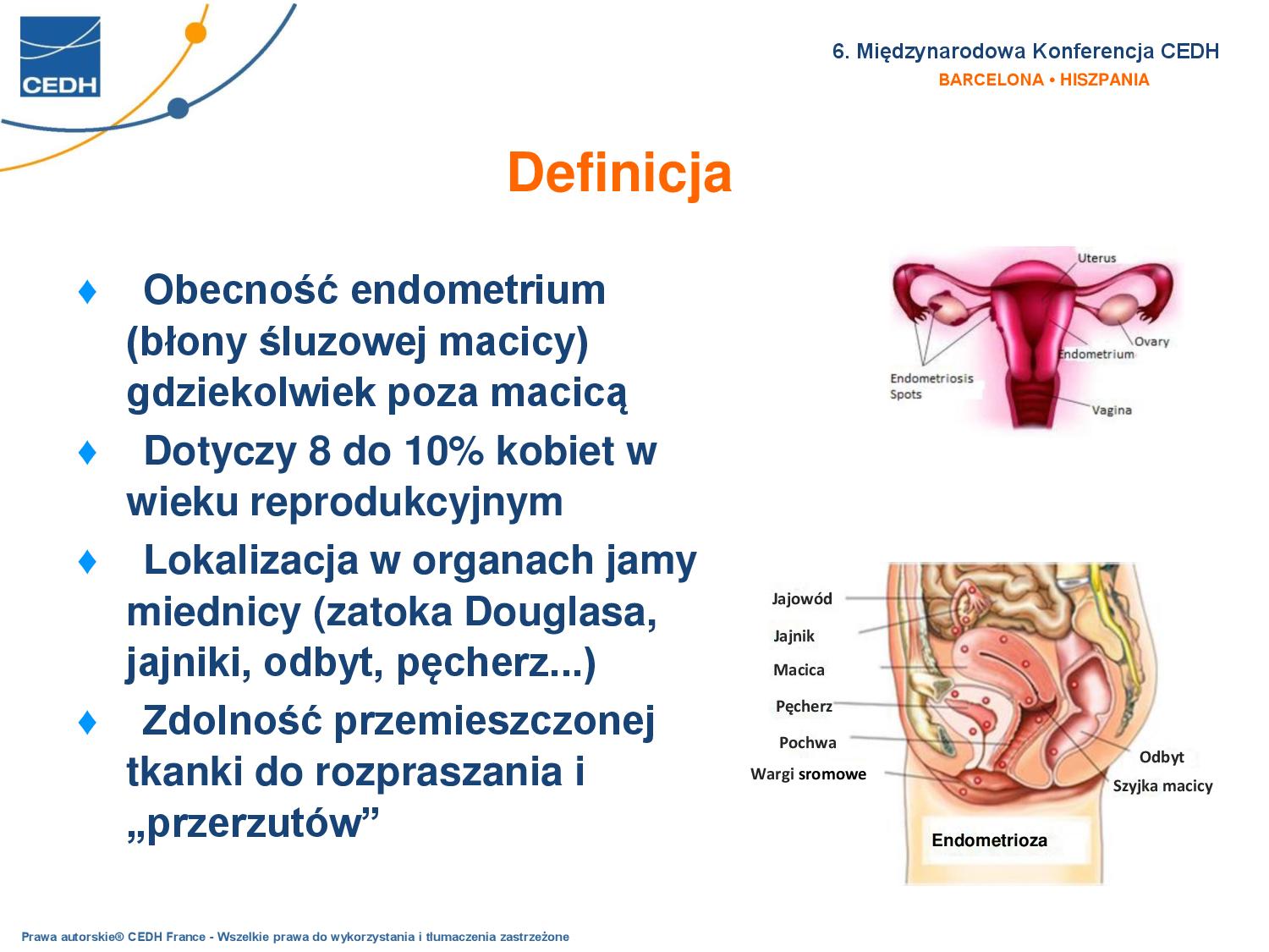 Endometriosis C. Charvet DEF EN PL271017 page 002